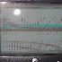 015 Contraction and FHR monitor